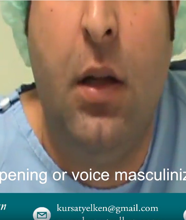 Voice Masculinization Surgery, Voice Deepening Surgery