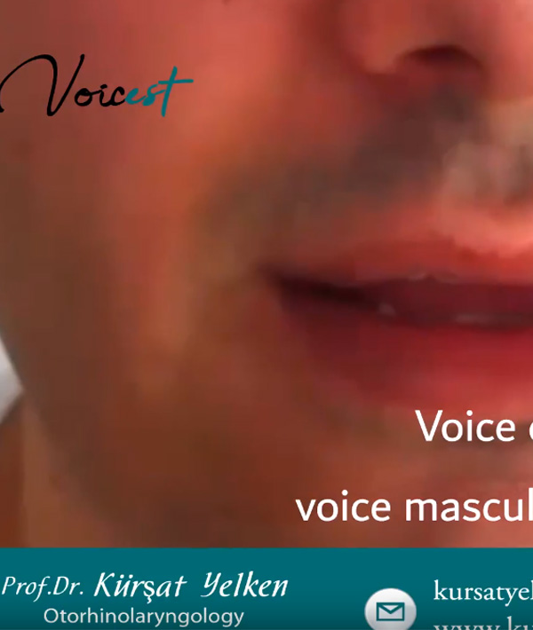 Voice Masculinization Surgery, Voice Deepening Surgery Surgery