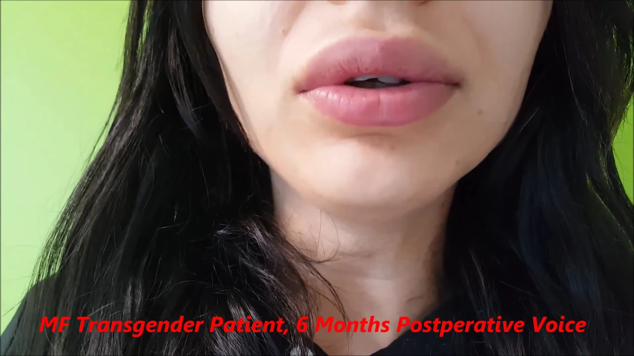 Ses Feminizasyon Ameliyatı